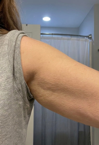 Before, Connie H, 46