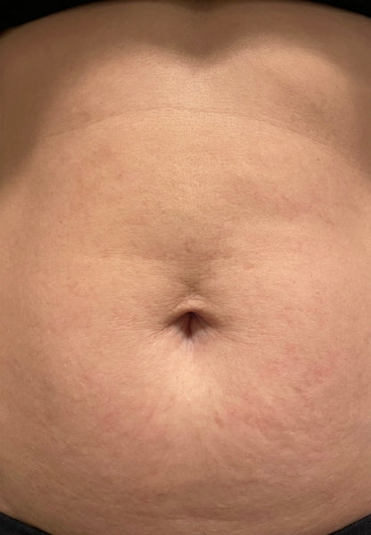 After 100 days, Holly D, 51