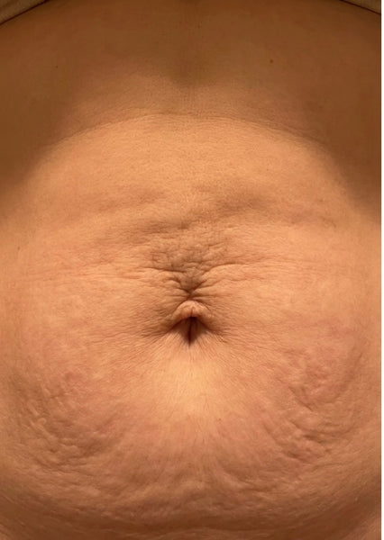 Before, Holly D, 51