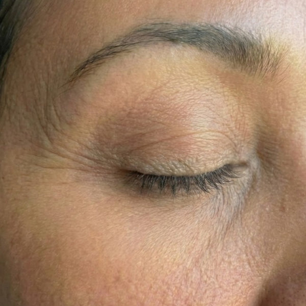Before – Kecia W, 42