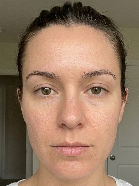 Before – Elisa S, 31