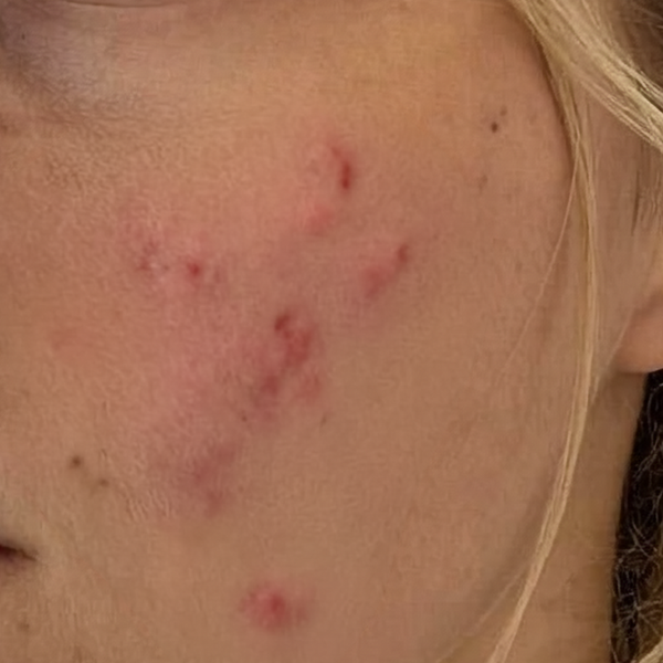 Before – Clara W, 18