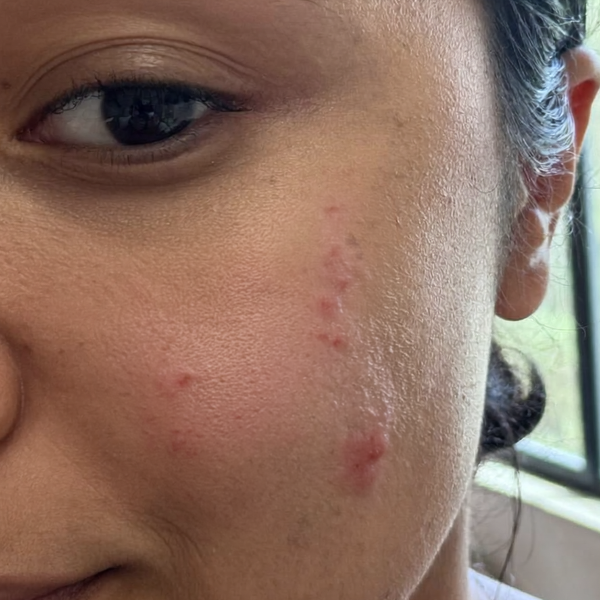 Before – Gabriela G, 26