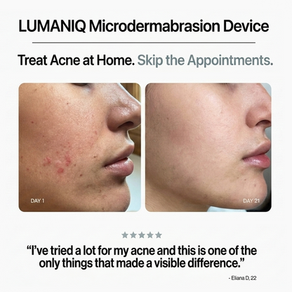 Diamond Microdermabrasion Device