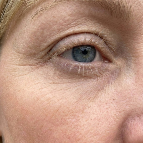 Before – Natasha L, 44