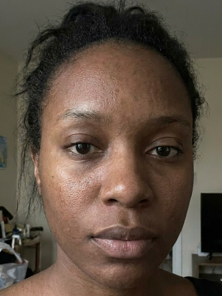 Before – Tasha G, 34
