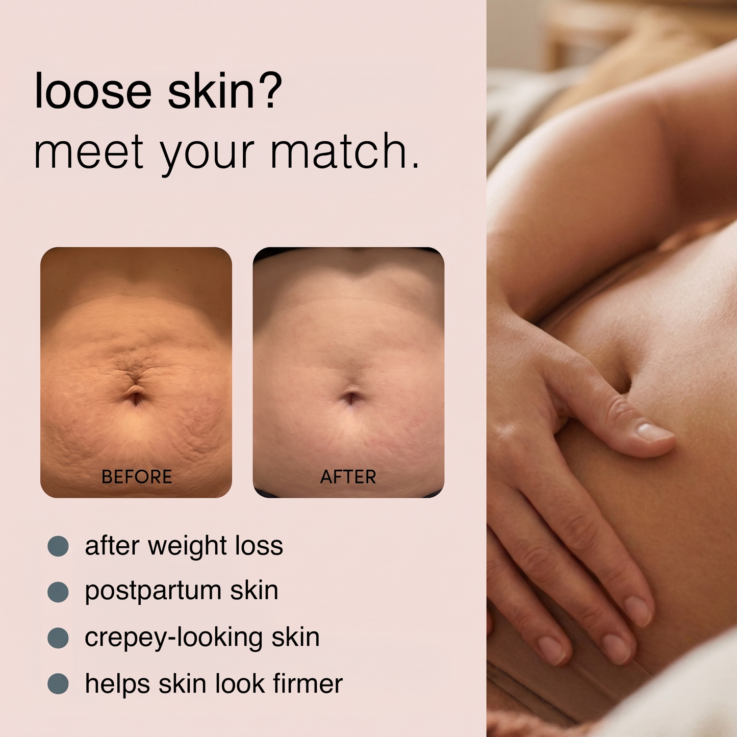 RF Skin Tightening Wand