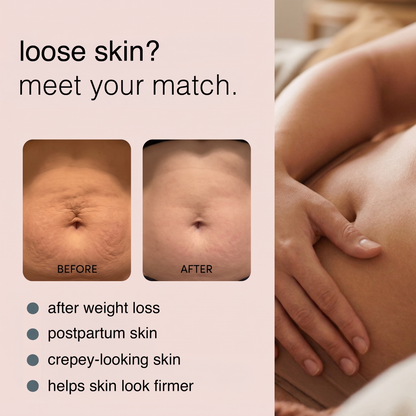 RF Skin Tightening Wand