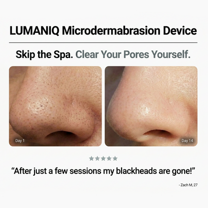 Diamond Microdermabrasion Device