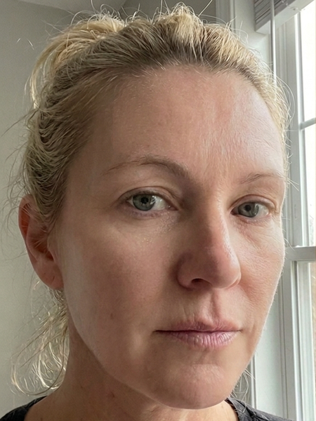 Before – Claire A, 31