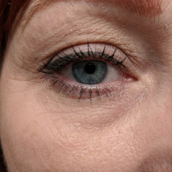 Before – Fiona S, 53
