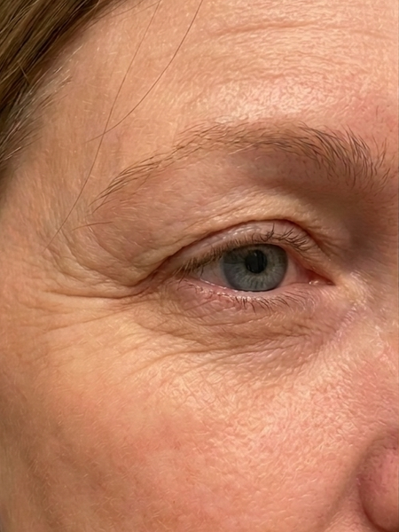 Before – Sofia G, 34