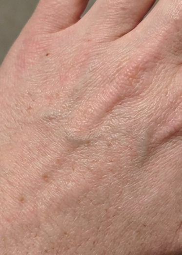 After 90 days, Susan, 54