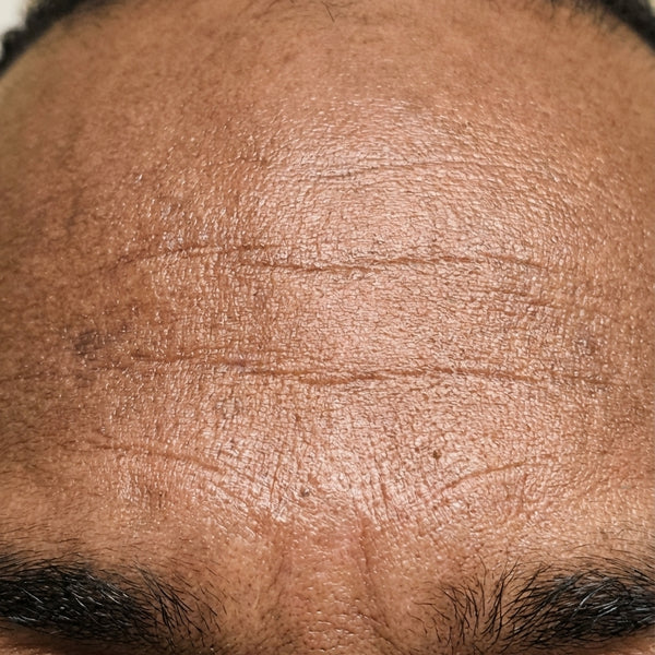 Before – Charles C, 53