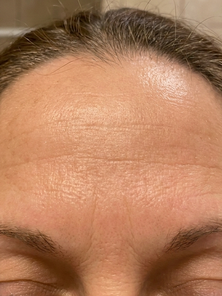 Before – Claire A, 39