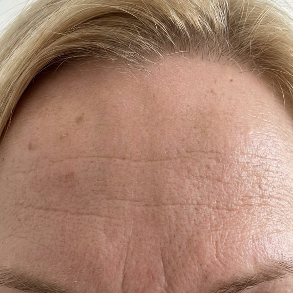 Before – Amy C, 58