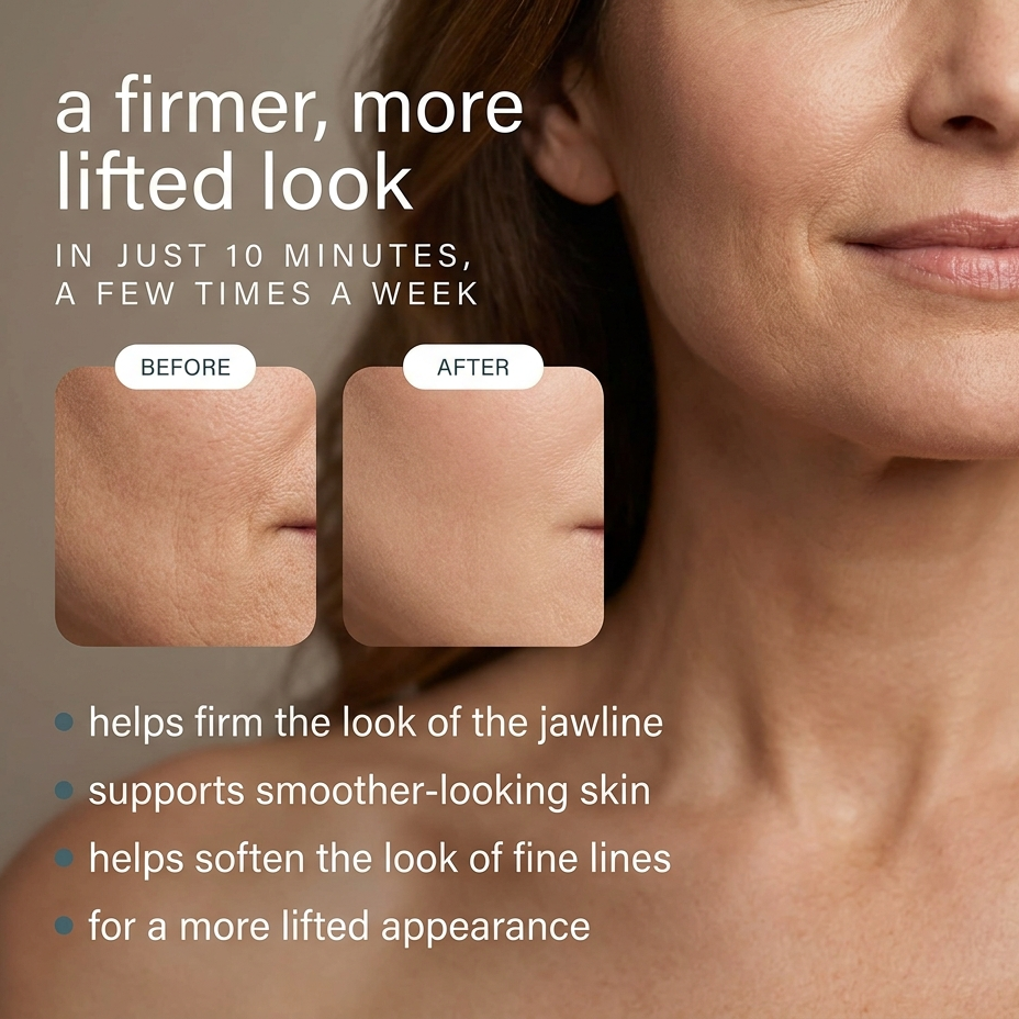 RF Skin Tightening Wand
