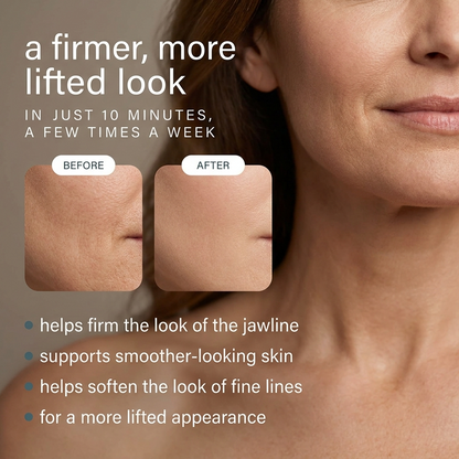 RF Skin Tightening Wand