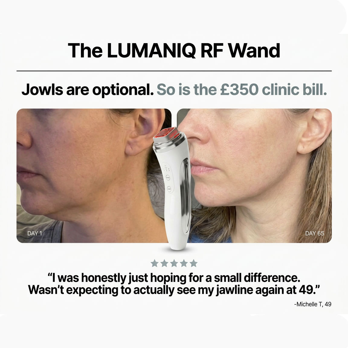 RF Skin Tightening Wand