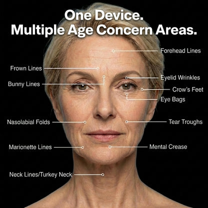 RF Skin Tightening Wand