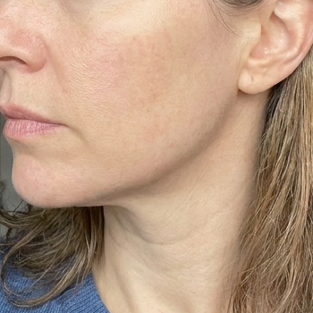 After 65 – Michelle T, 49