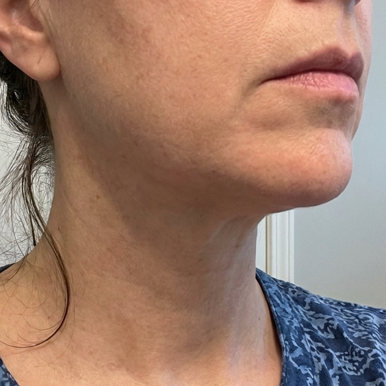 After 70 – Debra L, 54